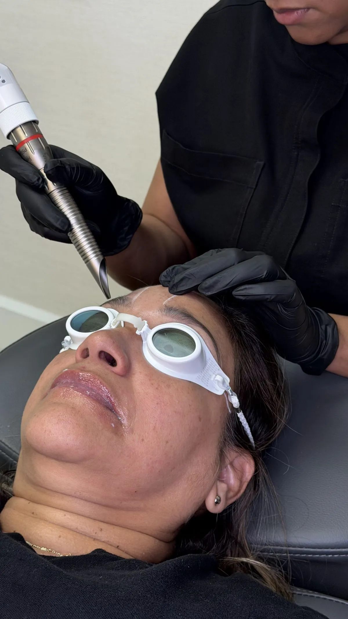 VectorLift treatment